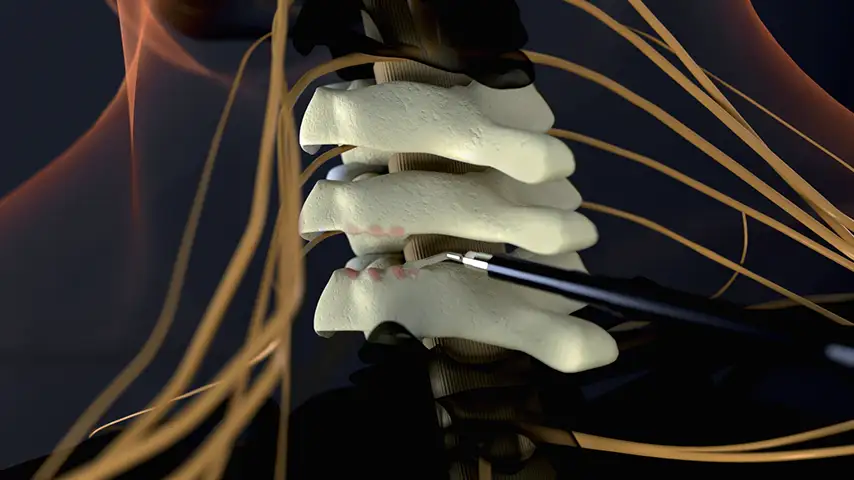 PIEZOSURGERY®