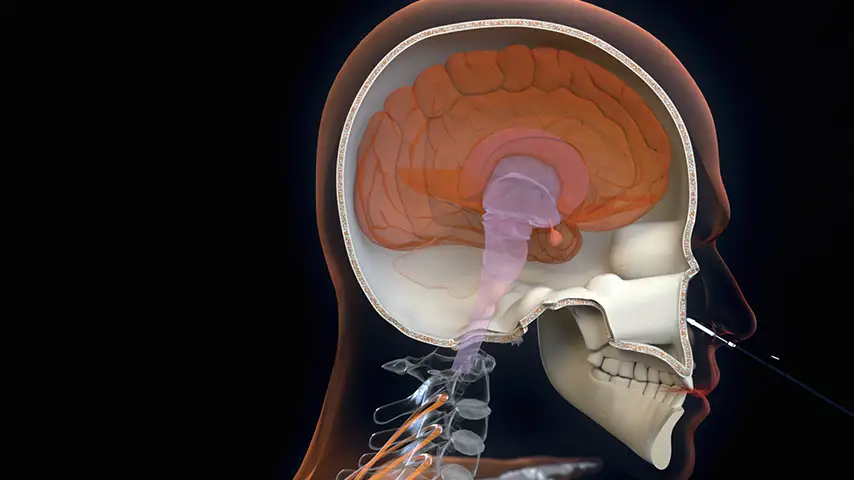 Endoscopic transsphenoidal approach